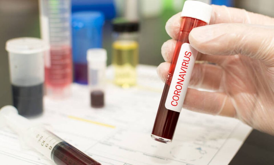 Concept to represent the 2020 virus threat Coronavirus, blood in a test tube.