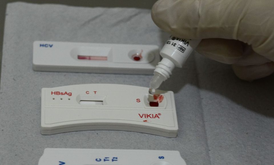 São Paulo - O Centro de Referência de Álcool, Tabaco e Outras Drogas (Cratod), oferece teste rápidos e gratuitos para HIV, Hepatite B e C e Sífilis, em Bom Retiro, na região central (Rovena Rosa/Agência Brasil)