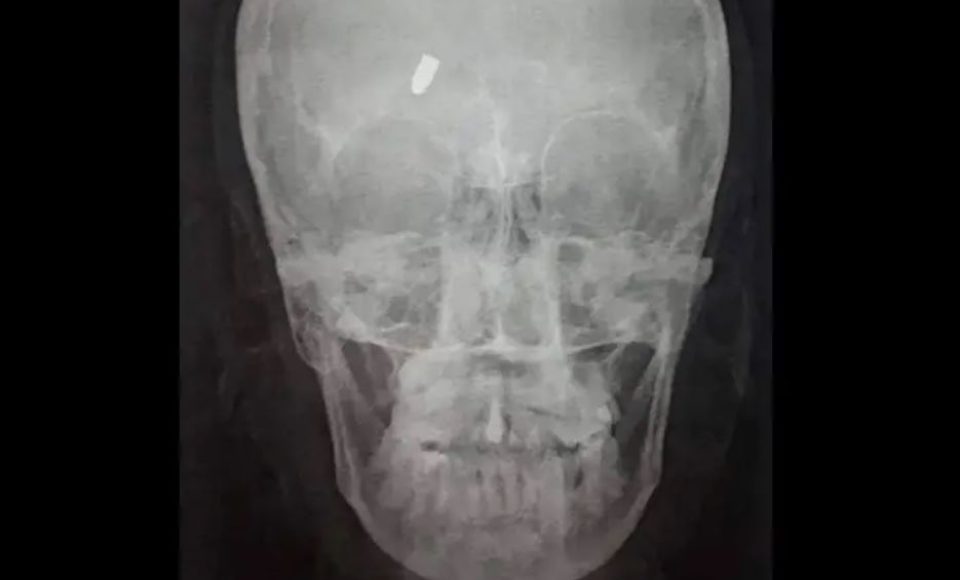 Foto: Hora Certa