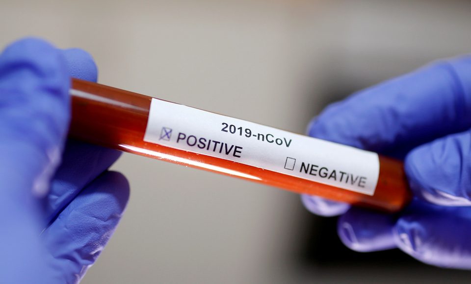 FILE PHOTO: Test tube with Corona virus name label is seen in this illustration taken on January 29, 2020. REUTERS/Dado Ruvic/File Photo