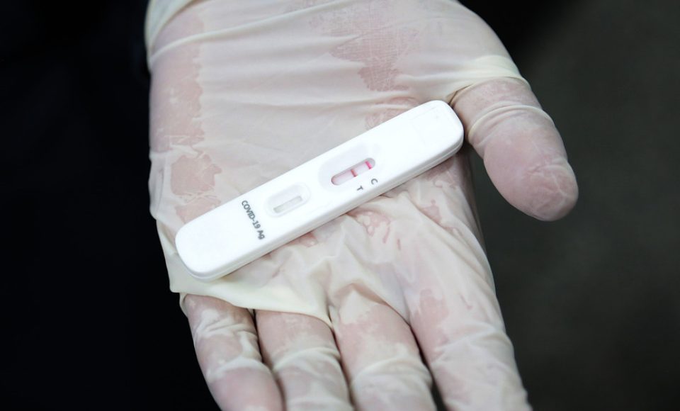 A Secretaria de Estado da Saúde (Sesa) está enviando 85 mil testes rápidos imunocromatográficos para pesquisa do antígeno viral SARS-CoV-2 e 640 oxímetros aos municípios sede das 22 Regionais de Saúde, quatro municípios de fronteira, além de todos os municípios do litoral do Paraná. O objetivo é fortalecer o rastreio, monitoramento e isolamento de contatos relacionados à Covid-19.  -  Curitiba, 09/06/2021  -  Foto: Clevis Massolla